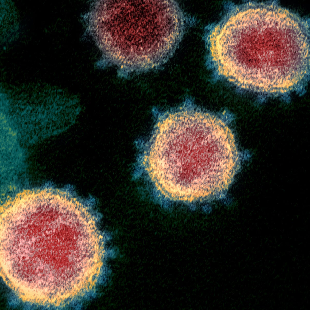 can you catch coronavirus twice what we know about covid 19 so far coronavirus the guardian can you catch coronavirus twice what we know about covid 19 so far coronavirus the guardian