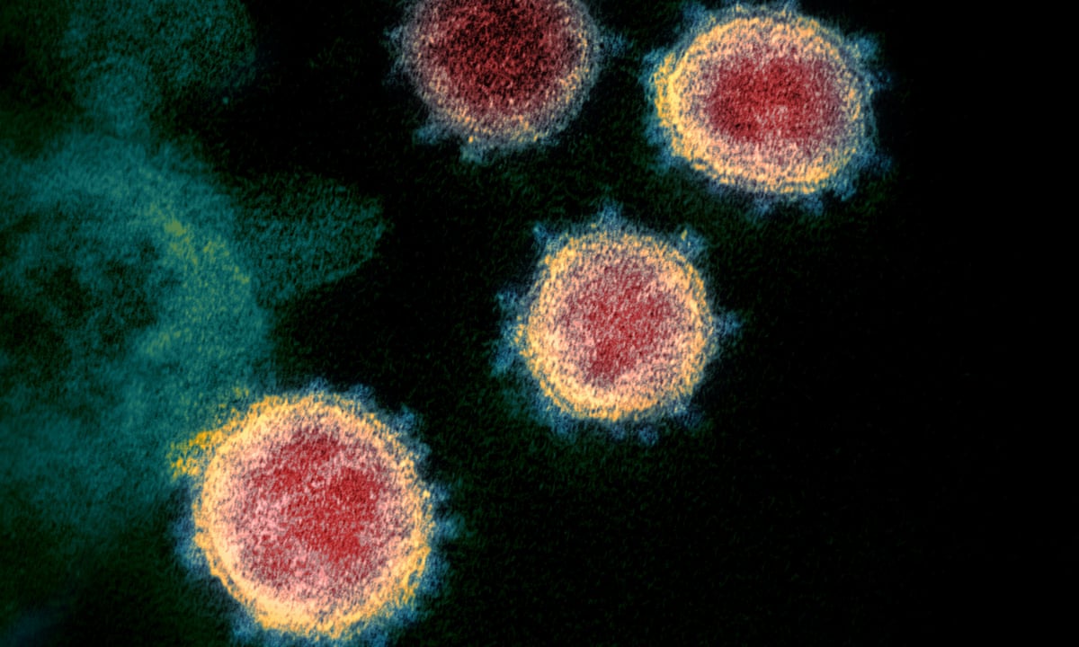 Can You Catch Coronavirus Twice What We Know About Covid 19 So Far Coronavirus The Guardian Can You Catch Coronavirus Twice What We Know About Covid 19 So Far Coronavirus The Guardian
