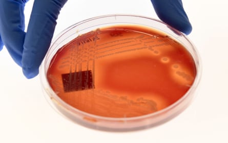 Gloved fingers address a petri dish with an orange substance internal 