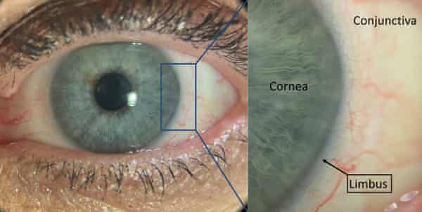A diagram showing an eye’s limbus and cornea.