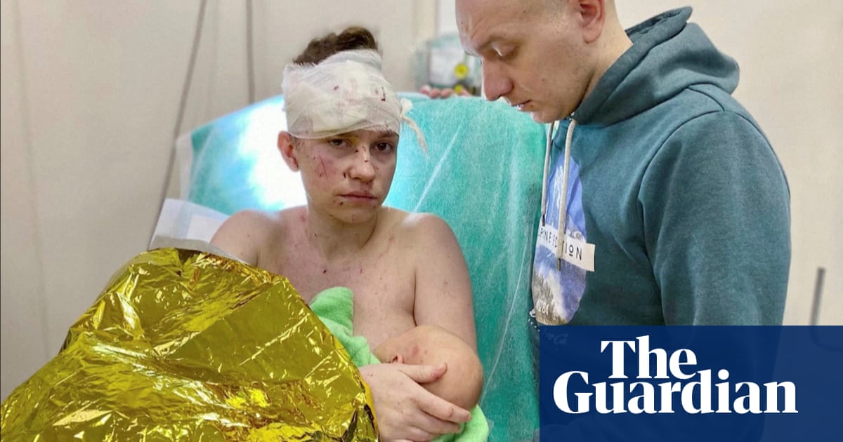 Ukrainian mother seriously wounded while shielding baby from missile strike