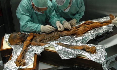 Scientists sample the stomach of Ötzi the iceman, who died in eastern Alps 5,300 years ago.