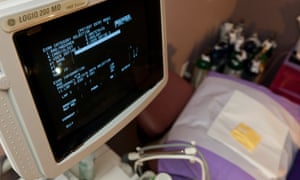 Advocates warn that the Prenatal Discrimination Act would force physicians to report on patients they suspect of having an abortion based on the fetus’s sex or race without having any real way of knowing.