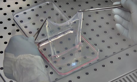Scientists grow replacement skin for boy suffering devastating genetic disorder