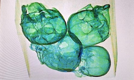 The skulls detected in the package by X-ray equipment at Queretaro airport