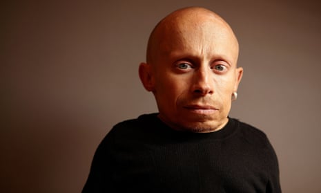 Verne Troyer during the 2009 Toronto film festival.