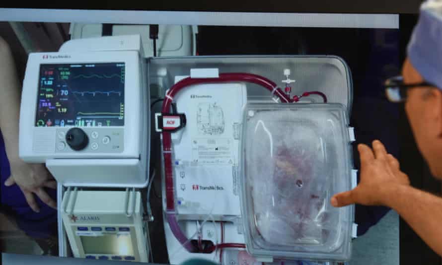 Success for first non-beating heart transplant in Europe | Science | The Guardian Success for first non-beating heart transplant in Europe | Science | The Guardian