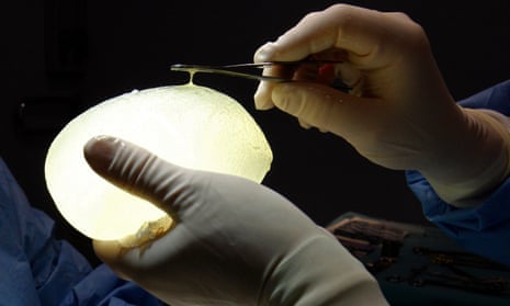 A defective textured breast implant