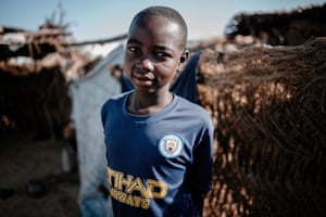 Bakura, 14, survived a landmine explosion that killed his young relative Mustapha.