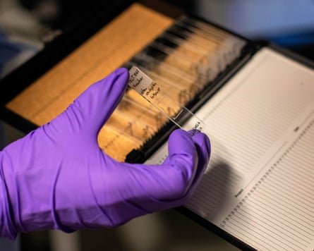 A hand wearing protective glove holds a glass slide