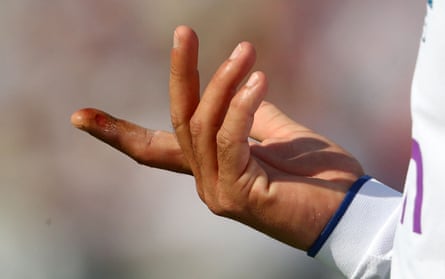 Flukes, Finger And Fumbles: Saat-saat Pertama Yang Menentukan Ashes Test | Abu | KoranPrioritas.com 46 Moeen Ali memeriksa jarinya yang berputar dan terluka