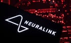 Neuralink has implanted second trial patient with brain chip, Elon Musk says Neuralink has implanted second trial patient with brain chip, Elon Musk says