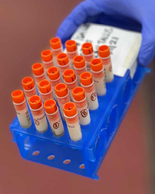 The vials to be sent to the International Space Station