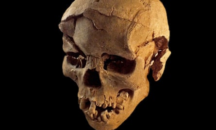 A skull dating back 10,000 years showing evidence of a crushing blow to the forehead.