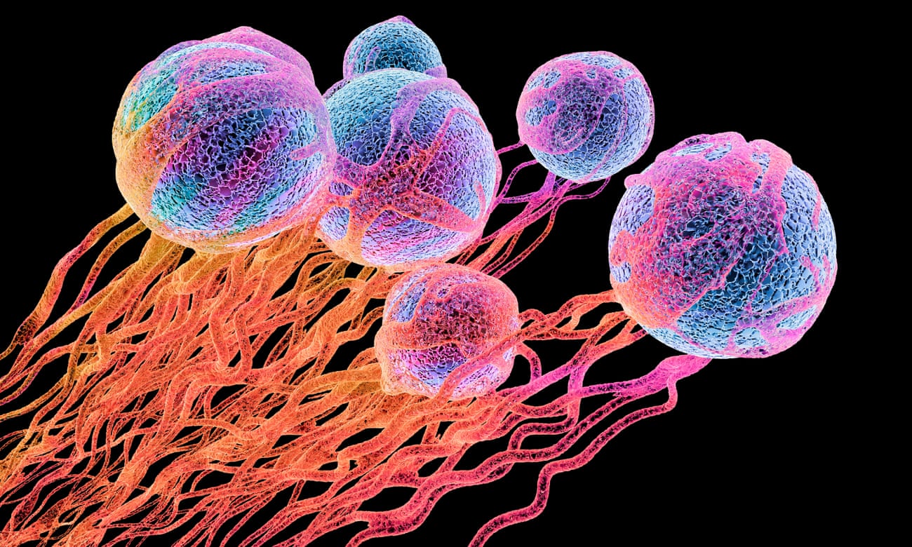 Computer illustration of cancer cells.