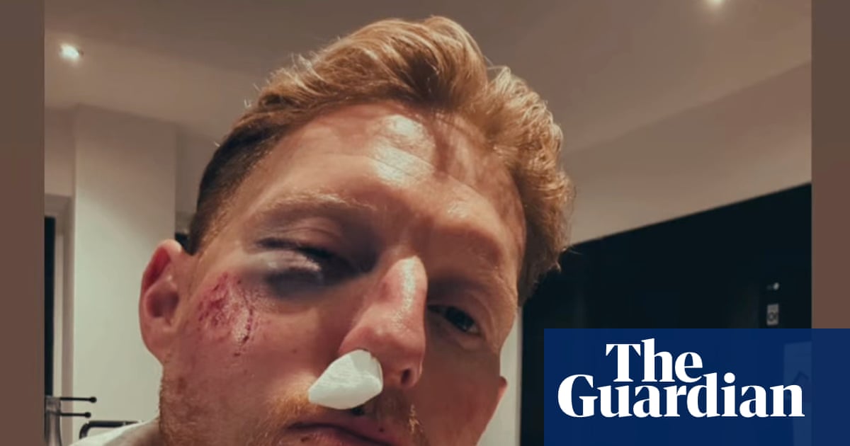 ‘You should see the cricket ball’ jokes Ben Stokes after being struck in the face