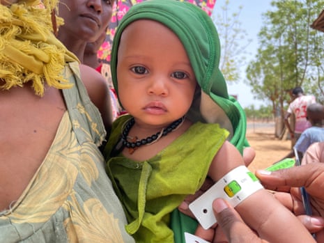 A child in Tigray. In one area, 65% of children under five  were malnourished.