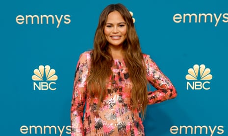 Chrissy Teigen: ‘The only celebrity known to have “admitted” to buccal fat removal”.’