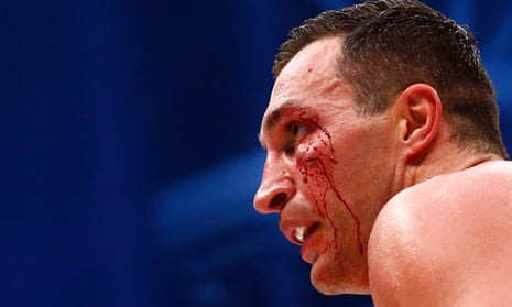 Wladimir Klitschko bleeds from a cut to the face.