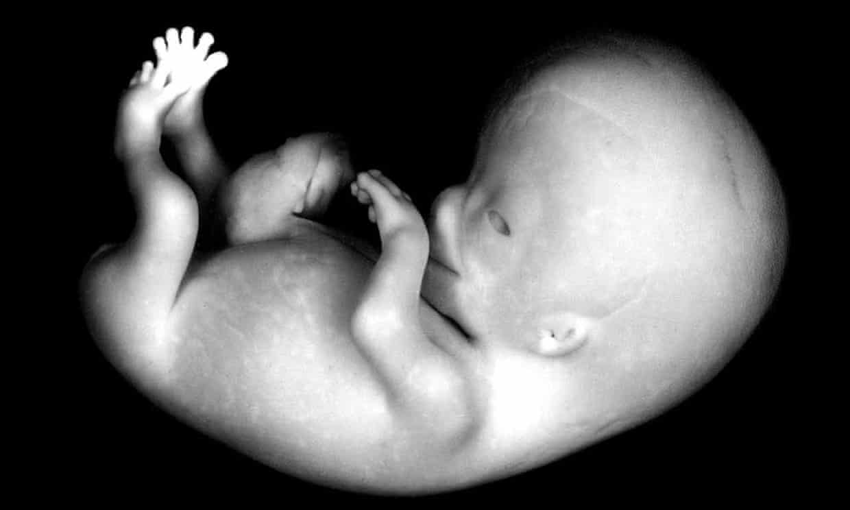 A human embyro (now a foetus) at 56-60 days