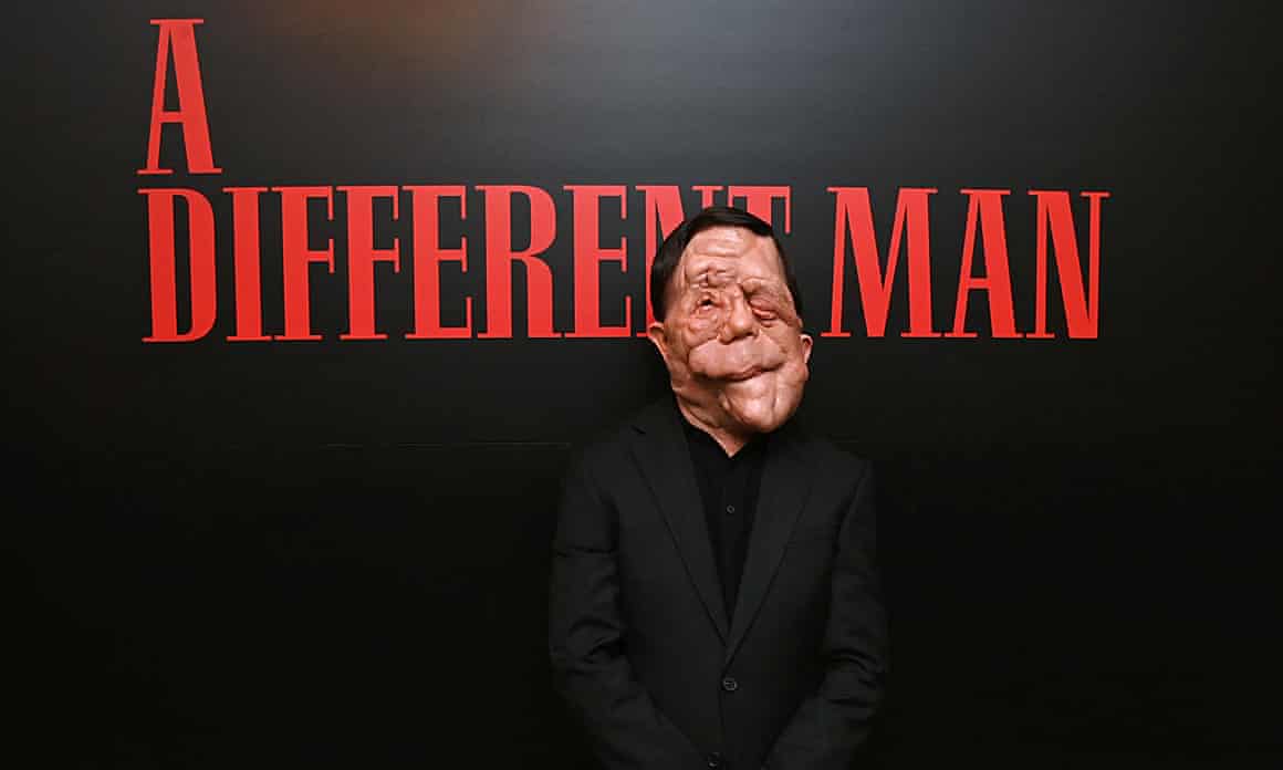Adam Pearson, wearing a black suit, stands before a black backdrop with A Different Man written in red.