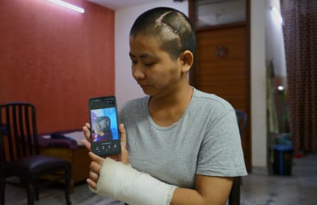Nancy Chingthianigng was attacked and injured by a mob in in Manipur