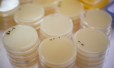 Petri dishes in the lab