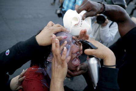 A protester has her eyes washed after being exposed to teargas in Minneapolis.