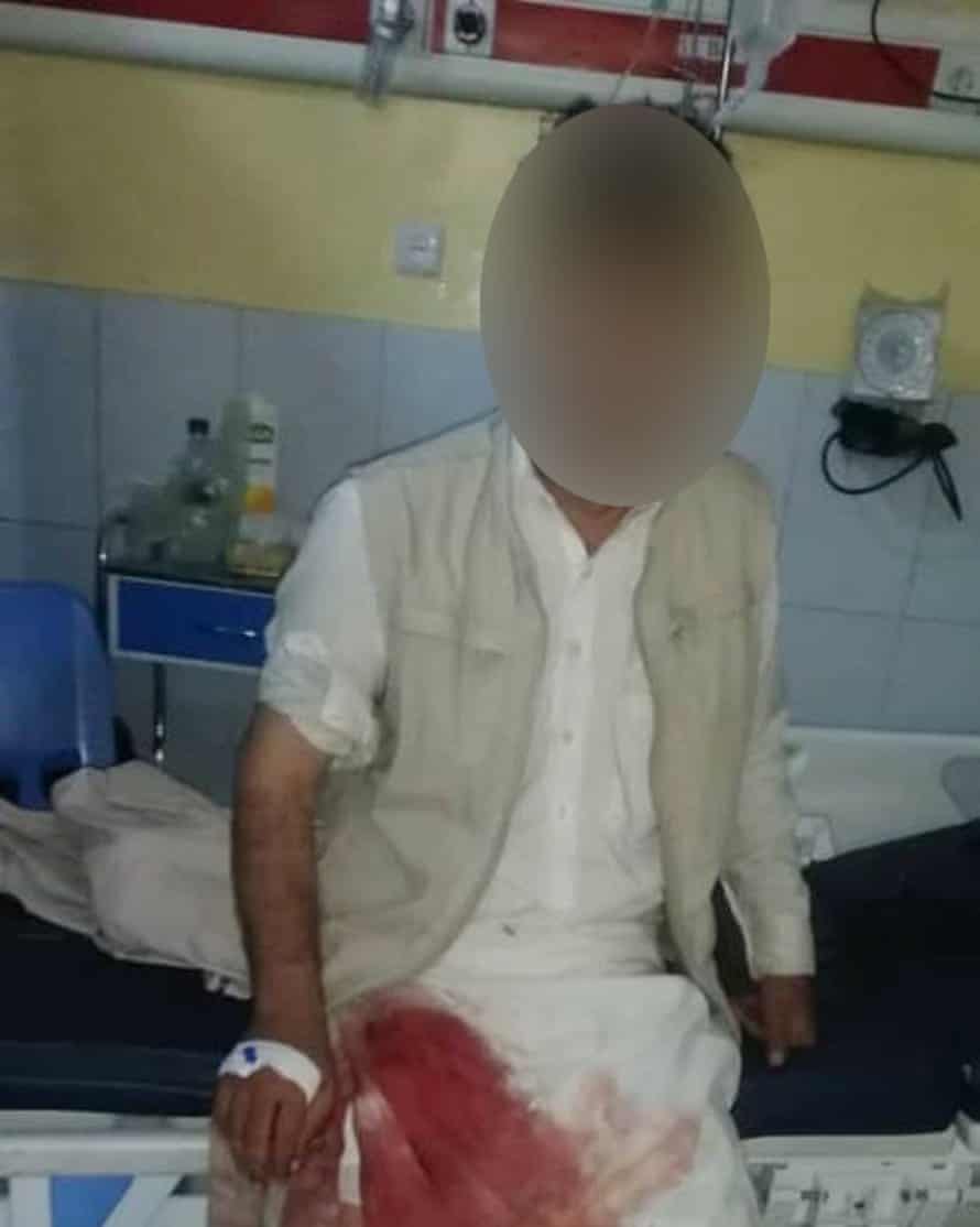 Un ancien interprète de l'armée australienne a reçu une balle dans la jambe alors qu'il tentait de se rendre à l'aéroport de Kaboul