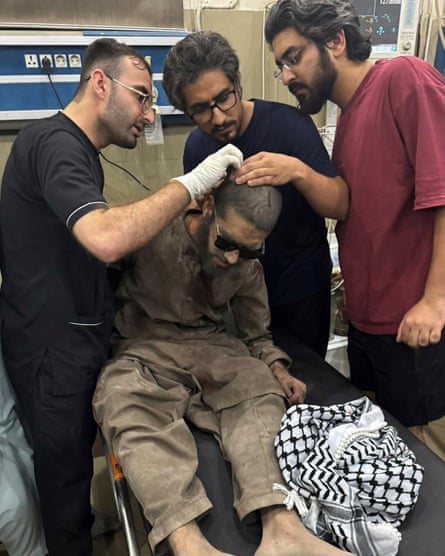 Three doctors examine the back of the head of a man sitting up on a gurney