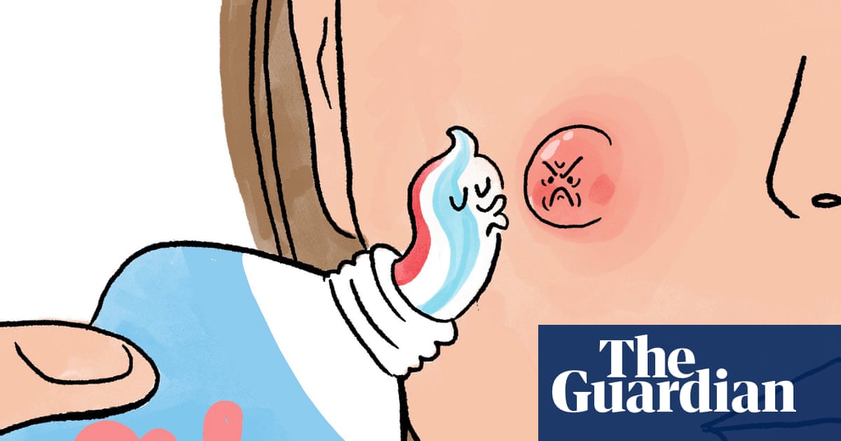 Toothpaste on pimples? Dermatologist warns it can make spots worse