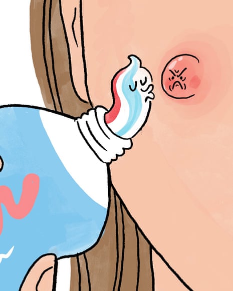 A tube of cream with a cartoon face squeezes onto a face, next to an angry-looking red spot
