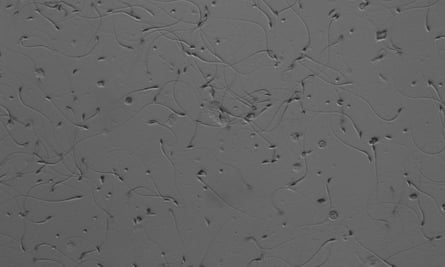 Kangaroo sperm under a microscope