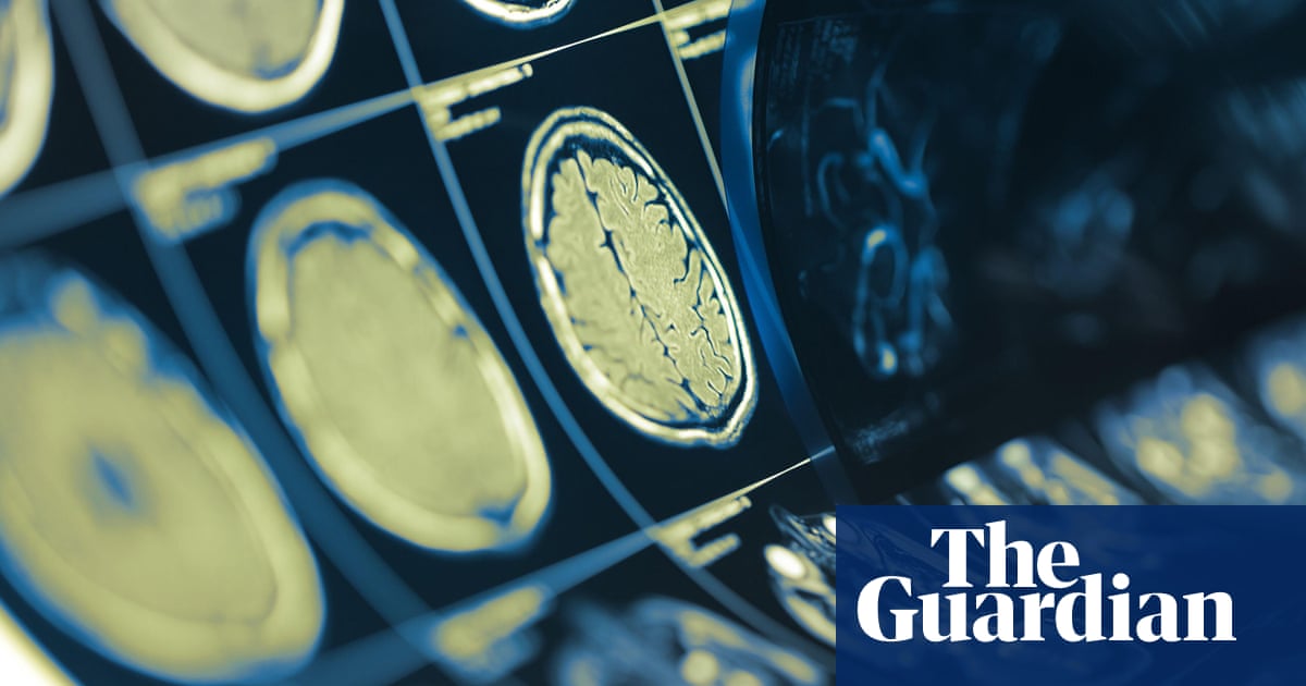 Gift of life': experts hail neck and head cancer breakthrough