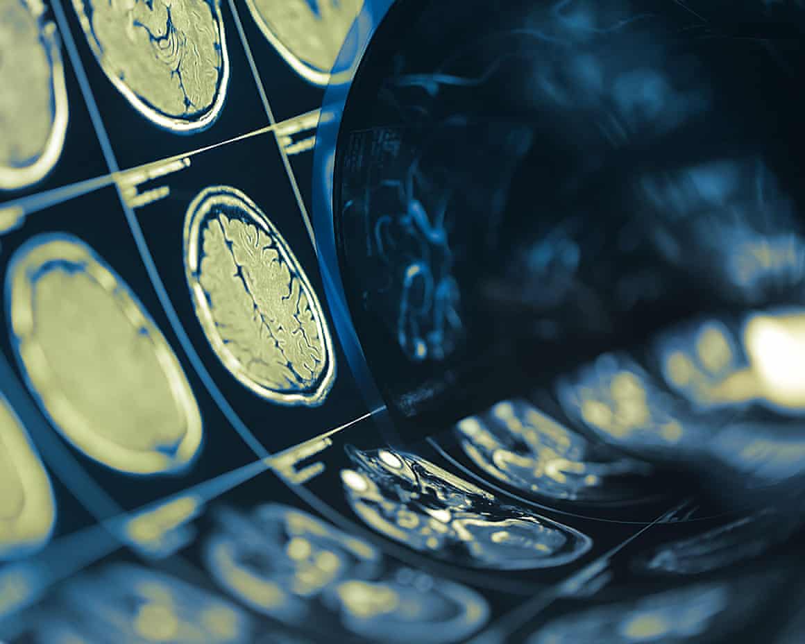 Human brain scan testing film folded in a roll, medical background with space for your design.2HFJKYP Human brain scan testing film folded in a roll, medical background with space for your design.