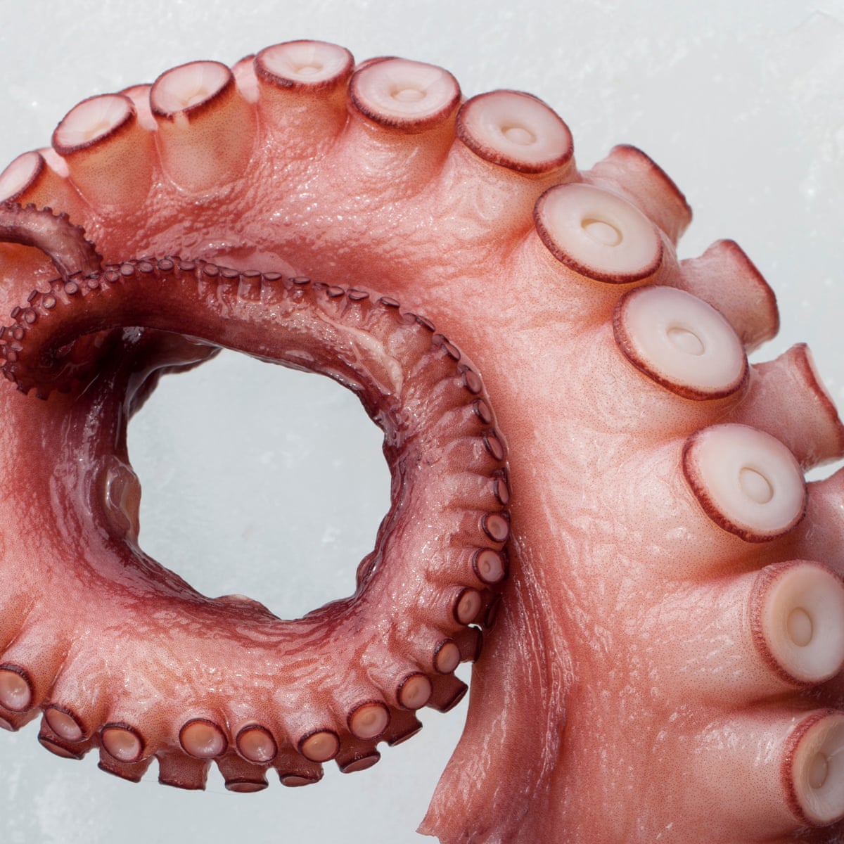 Octopus Pot Syndrome Why A Broken Heart Can Be As Bad As Cardiac Arrest Heart Attack The Guardian Octopus Pot Syndrome Why A Broken Heart Can Be As Bad As Cardiac Arrest Heart Attack The Guardian