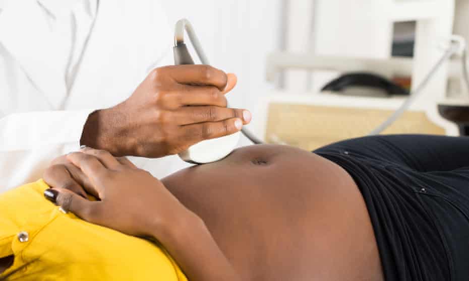 Doctor’s hand moving an ultrasound scanner on a pregnant BAME woman's stomach
