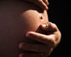 Why was a Florida woman forced to have a C-section? | Tayo Bero