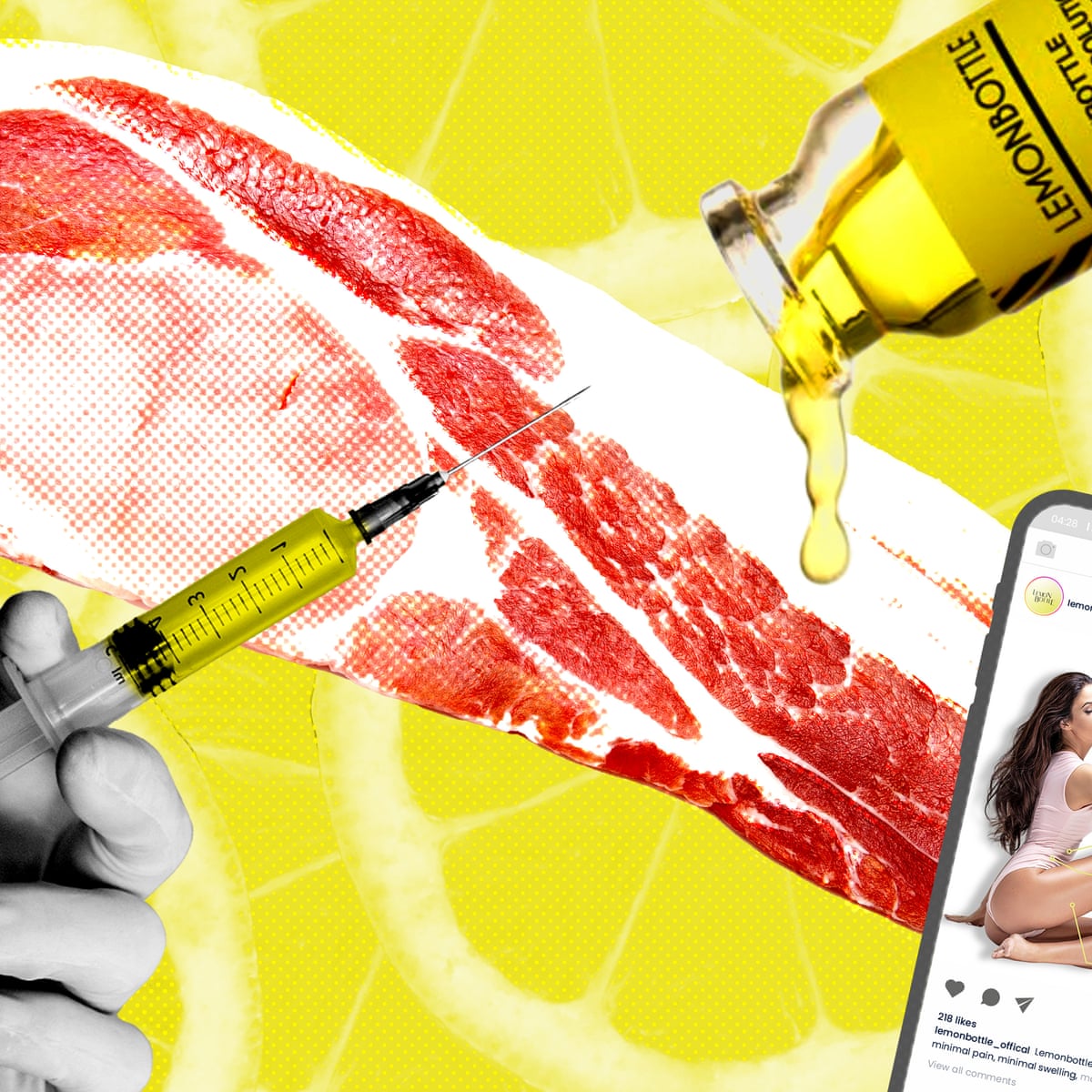 Lemon Bottle jab goes viral with claims to dissolve fat but doctors question safety | Health | The Guardian Lemon Bottle jab goes viral with claims to dissolve fat but doctors question safety | Health | The Guardian