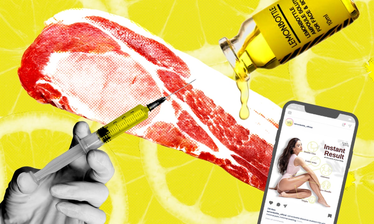 Lemon Bottle jab goes viral with claims to dissolve fat but doctors question safety | Health | The Guardian Lemon Bottle jab goes viral with claims to dissolve fat but doctors question safety | Health | The Guardian