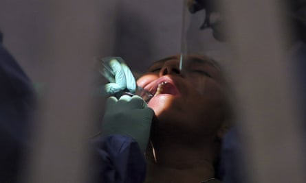 Dentist wearing latex gloves works on patient