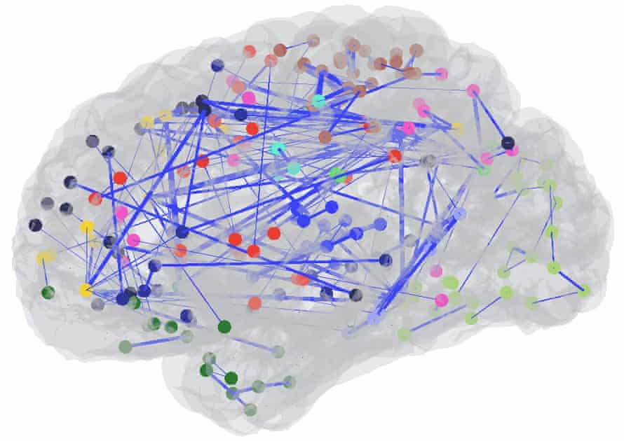 This figure shows the functional connectivity between nodes in Gareyev’s brain during a resting state. The colour of the circles denote different functional networks of the brain, and the blue lines show the strongest connections.