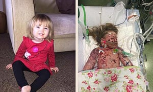 Image result for meningococcal b