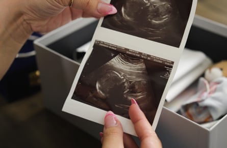close up of a pair of hands holding an ultrasound