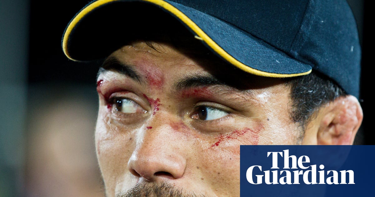 Shane Christie, rugby concussion campaigner who wanted to donate his brain, found dead at 39