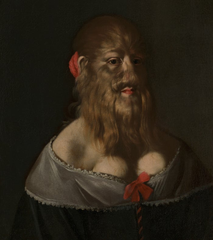 High Status Portrait Of Bearded Woman Bought By Wellcome
