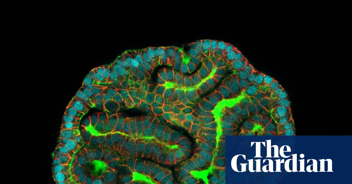 ‘A mouse can’t tell us what works’: UK scientists to grow miniature human organs for drug testing