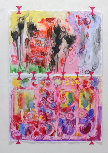 Gate Theory of Pain (III), 2024.