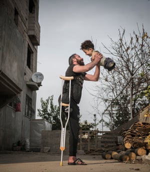 Photograph of the Year: Hardship of Life. Munzir lost his right leg when a bomb was dropped as he walked through a bazaar in Idlib, Syria. Here he is pictured in Hatay province, Turkey, with his son Mustafa, who was born without lower or upper limbs because of tetra-amelia syndrome, which was caused by the medications his mother, Zeynep, had to take after nerve gas attack during the war