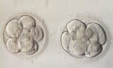 Ruth Whippman embryos